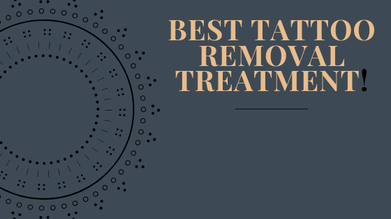 Best tattoo removal treatment review, if you want to find out which one is the best, read the whole article!