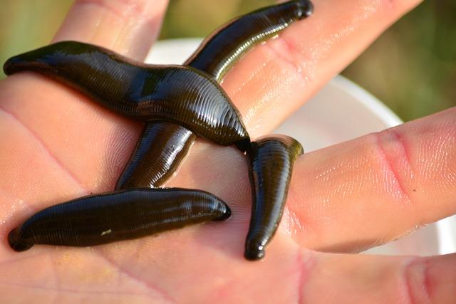 Nellie Bly with the Leeches: The Untold Medical Mystery 2 The Fascinating Use of Leeches in Historical Medical Treatments